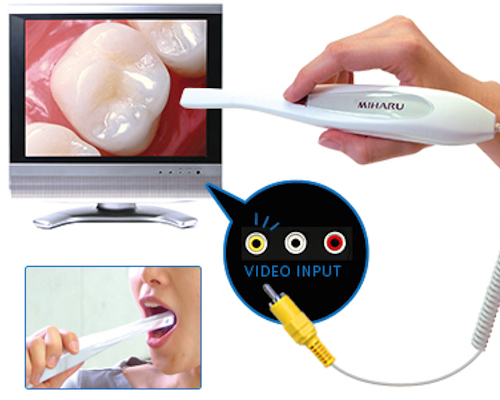 Miharu - Dental Intraoral Plaque Detection Camera
