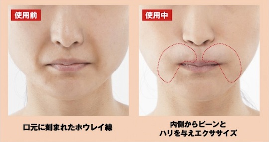 Dr Fukuoka Hourei Upper Laugh Lines Lifter - Nasolabial folds anti-aging beauty tool - Japan Trend Shop