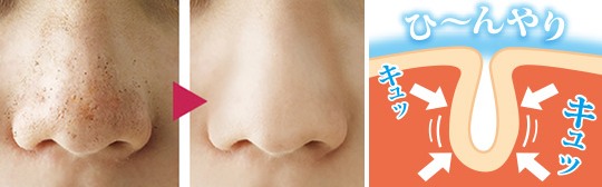 Nose Pore Blocker Hanabijin - Skin care treatment cap - Japan Trend Shop
