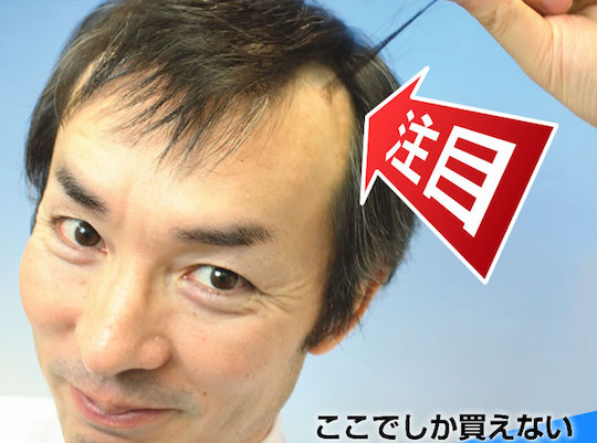 Quick Pon Hair Loss Concealer Sticks - Temporary hair transplant baldness remedy - Japan Trend Shop