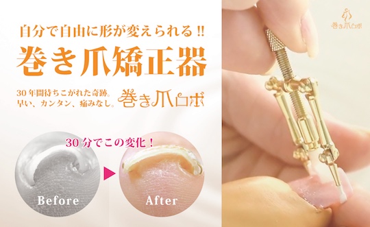 Makizume Robo Ingrown Toenail Fixer - Nail shape straightener - Japan Trend Shop