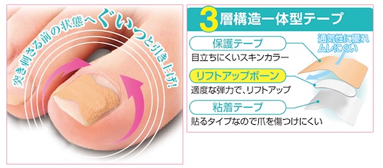 Ingrown Toenail Tape - Nail treatment sheets - Japan Trend Shop