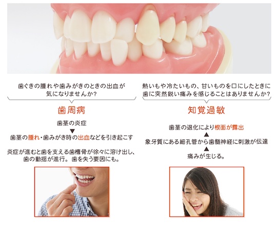 Soladey Gum Treatment plus Toothpaste - Gum inflammation, infection oral care gel - Japan Trend Shop